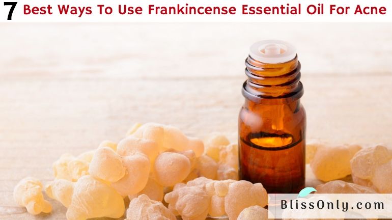frankincense essential oil for acne