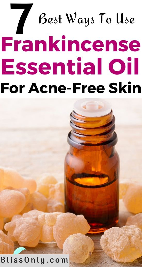 frankincense essential oil for acne